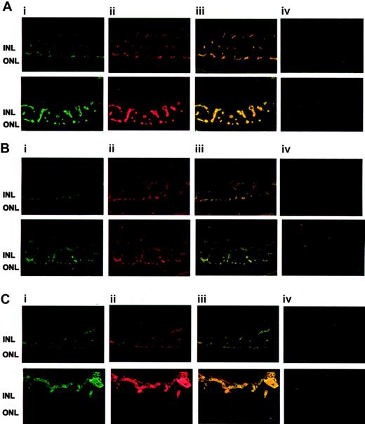 Figure 4. Up-regulation of β1-integrin and FN in the ROP model. (A) Typical fluorescence staining patterns for β1-integrin (i; green) and FN (ii; red) and the overlay picture (iii) and appropriate negative control (first antibody omitted) (iv) of retinas from control mice (top row) or mice subjected to the ROP model (bottom row) are shown. (B) Typical fluorescence staining patterns for β1-integrin (i; green) and PECAM-1 (ii; red) and the overlay picture (iii) and appropriate negative control (first antibody omitted) (iv) of retinas from control mice (top row) or mice subjected to the ROP model (bottom row) are shown. (C) Typical fluorescence staining patterns for PECAM-1 (i; green) and FN (ii; red) and the overlay picture (iii) and appropriate negative control (first antibody omitted) (iv) of retinas from control mice (top row) or mice that were subjected to the ROP model (bottom row) are shown. INL indicates inner nuclear layer; ONL, outer nuclear layer.