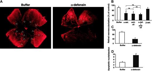 Figure 5. Inhibition of retinal angiogenesis by α-defensins. After 5 days of hyperoxia, mice were brought back to room air on p12 and were injected intraperitoneally or subconjunctivally with different treatments at different time points. (A) Typical photographs from lectin staining of retina whole-mount from a mouse that was treated with buffer alone or a mouse treated with synthetic α-defensin (HNP-1) intraperitoneally from p14 to p16 are shown. Arrowheads indicate the neovascular tufts. Neovascular regions are far more extensive in retinas from buffer-treated mice than in retinas from α-defensin–treated mice. (B) Retinal neovascularization was quantified on p17, as described in “Materials and methods.” Mice were treated from p14 until p16 once daily intraperitoneally with buffer, synthetic α-defensin (30 μg/mouse), blocking antibody to α5-integrin (30 μg/mouse), combination α-defensin and antibody to α5-integrin (each 30 μg/mouse), or β-defensin (30 μg/mouse). Retinal neovascularization is presented as percentage of control, defined as neovascularization in the presence of buffer only. Data are mean ± SD (n = 5 mice). (C) Retinal neovascularization was quantified on p17. Mice were treated on p14 with a subconjuctival injection into one eye of buffer or synthetic α-defensin (5 μg/eye). Retinal neovascularization is presented as percentage of control, defined as neovascularization in the presence of buffer only. Data are mean ± SD (n = 5 mice). * P < .05 compared with buffer; ns indicates not significant. (D) Induction of apoptosis by α-defensins in the ROP. Apoptosis in the retinas of 4 mice treated with buffer or 4 mice treated with α-defensin (30 μg/mouse) intraperitoneally from p14 until p17 was quantified. Apoptosis was determined by TUNEL by counting 15 sections per eye and is shown as number of apoptotic nuclei per section. *P < .05 compared with buffer.