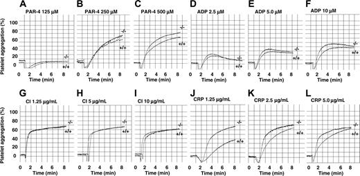 Figure 2. PECAM-1–deficient platelets display normal platelet aggregation responses to G-protein–coupled agonists, PAR-4 peptide, ADP, and calcium ionophore, but are hyperresponsive to GPVI-specific agonist collagen-related peptide (CRP). Aggregation responses of PRP (platelet count adjusted to 100 × 109/L) for wild-type and PECAM-1–/– mice were determined following activation with different concentrations of various agonists. (A-C) PAR-4 agonist peptide used at 125, 250, and 500 μM, respectively. (D-F) ADP used at 2.5, 5, and 10 μM, respectively. (G-I) Calcium ionophore (CI) A23198 used at 1.25, 5, and 10 μg/mL, respectively. (J-L) CRP used at 1.25, 2.5, and 5 μg/mL, respectively.