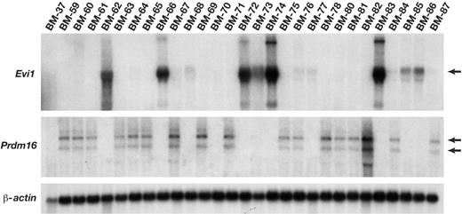 Figure 4. Evi1 and Prdm16 mRNA expression is activated by MSCV integrations. Northern blot analysis of Evi1 and Prdm16 expression in immortalized cell lines using probes specific for each gene. β-actin was used as a loading control. Lines BM-62, BM-72, and BM-83 have confirmed Evi1 integrations, while lines BM-60, BM-67, BM-69, BM-75, BM-80, and BM-81 have confirmed Prdm16 integrations. Lines BM-37 and BM-70 have neither integrations.