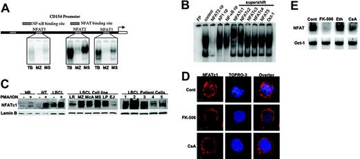 Figure 2. Constitutive activation of NFAT is required for CD154 expression in LBCL cells. (A) NFAT sites NFAT1 (-74 to -56), NFAT2 (-270 to -252), and NFAT3 (-768 to -750) on the CD154 promoter were synthesized and used as probes for EMSA with nuclear extracts from tonsillar B cells (TB), LBCL-MZ cells, and LBCL-MS cells. (B) Nuclear extracts from LBCL-MS cells were incubated with NFAT2 cold probe, AP-1 cold probe, NF-κB cold probe, or antibody against NFATc1, NFATc2, NFATc3, NFAT4, NFAT5, or Oct-1, and analyzed by EMSA with the NFAT2 p32-labeled probe. FP indicates free probe alone. (C) Nuclear extracts (50 μg) from normal B cells (NB), normal T cells (NT), LBCL cell lines, and primary LBCL cells from patients were analyzed by Western blot for NFATc1 expression. As indicated (- or +), cells were stimulated with PMA (20 ng/mL) and ION (1 μM). Lamin B indicates equal loading of nuclear extracts. (D) Control LBCL-MS cells and cells treated with FK-506 (5 μg/mL) or CsA (5 μg/mL) were fixed with methanol, stained for NFATc1 (red) and nuclear marker TOPRO-3 (blue), and analyzed by confocal immunofluorescence microscopic analysis. (E) Nuclear extracts from cells from panel D were analyzed for NFAT2 DNA binding by EMSA analysis. Ethanol was used as a control vehicle. Oct-1 DNA binding was used as an internal loading control.