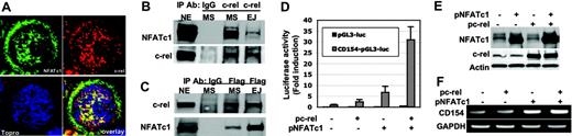 Figure 4. NFATc1 and NF-κB c-rel directly interact and synergistically regulate CD154 gene transcription in LBCL cells. (A) LBCL-MS cells were fixed with methanol and stained for NFATc1 (green), c-rel (red), and nuclear marker Topro (blue) and analyzed by confocal immunofluorescence analysis. Colocalization of NFATc1 and c-rel appears yellow. (B) Nuclear extracts from LBCL-MS and LBCL-EJ cells were immunoprecipitated with a polyclonal c-rel antibody or IgG antiserum (negative control). Immunoprecipitated complexes were resolved on SDS–polyacrylamide gel electrophoresis (PAGE), and subjected to Western blotting with anti-NFATc1 or anti–c-rel antibody. NE indicates 25 μg of nuclear extract from MS cells. (C) Because the NFATc1 antibody was poor for immunoprecipitation, LBCL-MS and LBCL-EJ cells were transfected with the Flag-tag-NFATc1 expression vector, and their nuclear extracts were used for coimmunoprecipitation with anti-Flag antibodies and immunobloting with c-rel or NFATc1. NE indicates 10 μg of nuclear extracts from MS cells. (D) LBCL-MS cells were cotransfected with CD154p-luc reporter and the expression vector for c-rel (pc-rel, 10 μg), NFATc1 (pNFATc1, 10 μg), or both. The pGL3 empty reporter plasmid was used as a negative control. After 24 hours, luciferase activity was determined and corrected for transfection efficiency using β-gal activity. The data are representative of 3 independent experiments. The error bars indicate the standard deviation of triplicate samples. (E) Whole-cell lysates from panel D were also analyzed for NFATc1, c-rel, and actin protein expression. Actin was used as an internal loading control. (F) Transfected cells from panel D were also used to obtain total RNA for analysis of CD154 mRNA by RT-PCR. GAPDH transcripts were measured to indicate equivalent amounts of RNA used for each reaction.