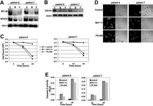 Figure 7. Effects of BAY-11 and FK-506 in primary biopsy-derived LBCL cells. Primary LBCL cells (patients 6 and 7) were left untreated (C; control) or were treated with BAY-11 (B; 1 μM) or FK-506 (F; 5 μg/mL) for 24 and 48 hours. Nuclear extracts purified from 48-hour treated tumor cells were analyzed for NF-κB, NFAT, and Oct-1 DNA binding by EMSA (A). Cytoplasmic extracts from part (A) were analyzed for CD154 and actin protein expression (B). (C) Control and treated cells were counted using the trypan blue exclusion counting method after 24 and 48 hours of treatment. (D) Control and treated cells were analyzed for apoptotic cells using the TUNEL assay. Green fluorescence represents apoptotic cells. (E) Caspase 3 activity was also measured in control and treated cell lysates. The data obtained in Figure 7 were repeated only once due to shortage of primary LBCL cells.