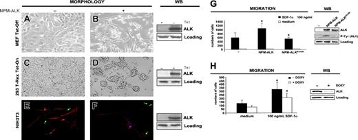 Figure 1. Morphologic changes induced by NPM-ALK. (A-B) MEFs Tet-Off show spindle-transformed cell shape when NPM-ALK is expressed. MEFs Tet-Off were stably transfected with the inducible vector NPM-ALK pBIEGFP and forced to express NPM-ALK when grown in medium deprived of tetracycline for 48 hours. (C-D) The 293 T-Rex Tet-On cells undergo changes in adherence when NPM-ALK is induced by adding tetracycline to the culture medium for 24 hours. Contrast-phase images; 40×/0.55 objective lens. (E-F) NIH3T3 fibroblasts were infected with Pallino NPM-ALK retrovirus and then incubated with monoclonal antipaxillin primary antibody followed by FITC-conjugated secondary antibody (green) and with PE-conjugated phalloidin to stain the actin filaments (red). Noninfected NIH3T3 cells (E) show a spread morphology, with clearly detectable actin filaments ending in the focal contacts (red arrows) and with organized paxillin clusters (green arrows), whereas NIH3T3 NPM-ALK cells (F) show only few actin filaments (red arrow) and rare paxillin clusters (green arrows). Images were taken with the Leica confocal microscope using a 63×/1.32 objective lens. Right panels show NPM-ALK expression by WB in the corresponding cells. Samples were blotted with anti-ALK monoclonal antibody. (G) CEM cells were infected with retroviruses expressing NPM-ALK or the kinase-dead mutant NPM-ALKK210R as control and then sorted for GFP expression. The histograms represent the numbers of cells migrated in response to SDF-1α in a transwell assay. The histograms summarize the results of 3 independent experiments using triplicate wells for experimental point. The right panels show NPM-ALK expression and phosphorylation by WB in the corresponding cells. Samples were blotted with anti-ALK and anti-PY20 monoclonal antibodies. (H) NPM-ALK silencing by ALK-shRNA decreases the migration rate of TS cells. TS cells were cotransduced with pLVTH ALK-shRNA and pLV-tTRKRAB vectors to obtain a doxycycline-dependent inducible NPM-ALK silencing. Cells were grown in the presence of doxycycline (1 μg/mL) for 72 hours. The histograms represent the numbers of cells migrated in response to SDF-1α in a transwell assay. The histograms are from 3 independent experiments using triplicate wells for experimental point. The right panels show NPM-ALK expression by WB in the corresponding cells. Samples were blotted with anti-ALK monoclonal antibody. *Statistically significant as analyzed by Student t test.