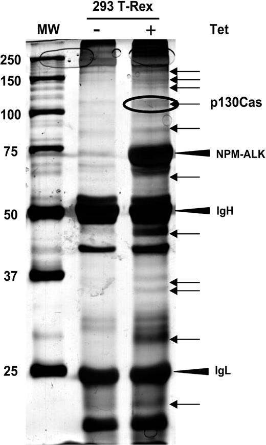Figure 2. Identification of p130Cas from silver-stained SDS-PAGE. The 293 T-Rex Tet-On cells were transfected with NPM-ALK and cultured for 24 hours in presence or absence of tetracycline. Thirty milligrams of total cell lysate was immunoprecipitated with a mixture of antiphosphotyrosine antibodies (4G10; Upstate Biotechnology; and PY20; Transduction Laboratories) and resolved on 8% SDS-PAGE. The gel was silver stained and the bands present only in the induced sample (+), as indicated by the arrows, were analyzed by mass spectrometry. Molecular marker is shown on the left. The p130Cas was identified from the circled band. See “Materials and methods” for details.