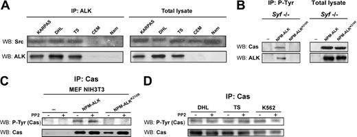 Figure 4. The phosphorylation of p130Cas by NPM-ALK is independent from Src tyrosine kinase activity. (A) NPM-ALK coprecipitates with Src in lymphoid cells. Total lysates from ALK-positive (Karpas, DHL, TS) and ALK-negative (CEM, Namalwa) cell lines were immunoprecipitated with anti-ALK monoclonal antibody and blotted with anti-Src polyclonal antibody. (B) The NPM-ALK–mediated phosphorylation of p130Cas is Src independent. Syf triple knock-out fibroblasts were cotransfected with Pallino p130Cas and Pallino NPM-ALK or Pallino NPM-ALKK210R as a control. Samples were collected 48 hours after transfection and total lysates were immunoprecipitated with anti-PY20 monoclonal antibody and blotted with the indicated antibodies. (C) Src inhibition does not limit p130Cas phosphorylation. MEF NIH3T3 cells were cotransfected with Pallino p130Cas and Pallino NPM-ALK or Pallino NPM-ALKK210R as a control. Forty-eight hours after transfection, samples were cultivated in the presence of 30 μM PP2 for 1 hour and then collected. The adaptor p130Cas phosphorylation levels were detected by immunoprecipitation with anti-p130Cas monoclonal antibody followed by blotting with anti-PY20 monoclonal antibody. (D) ALK-positive (DHL and TS) and ALK-negative (K562) cells were cultivated in the presence of 30 μM PP2 for 1 hour and then collected. The adaptor p130Cas phosphorylation levels were detected by immunoprecipitation with anti-p130Cas monoclonal antibody followed by blotting with anti-PY20 monoclonal antibody.
