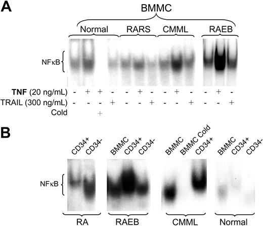 Figure 1. NF-κB activity in marrow cells. (A) Bone marrow mononuclear cells (BMMCs) from healthy controls (shown are representative results from 1 of 3 marrows) and patients with MDS were treated with either TNF-α or TRAIL at the indicated concentrations for 20 hours. Nuclear extracts were isolated, and 32P NF-κB gel shift was performed. Unlabeled probe (Cold) was used for competitive inhibition. Shown are representative examples from patients with refractory anemia with ringed sideroblasts (RARS; tested were marrows from patients 10 and 11; shown are results from patient 10); chronic myelomonocytic leukemia (CMML; tested were patients 23 and 25; shown is patient 23) and RA with excess blasts (RAEB; tested were patients 13, 17, and 20; shown is patient 17). (B) EMSA for NF-κB using nuclear extracts from purified CD34+ and CD34- marrow cells compared with unfractioned BMMCs from primary MDS cells; equal amounts of protein were loaded for each patient (healthy controls and patients with CMML and RAEB are the same as in panel A; RA patients tested were 2, 5, and 7; shown are results in patient 7).
