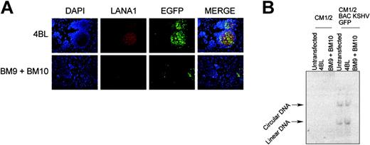 Figure 3. BM9 or BM10 expression promotes loss of KSHV plasmid in CM12 during transient transfection. Gardella gel electrophoresis followed by Southern blot hybridization with a TR probe shows loss of viral genome from CM12 cells stably transfected with KSHV-BAC36 GFP and transiently transfected with BM9 and BM10. Transfection with the negative control 4BL intrabody has no effect on viral persistence.