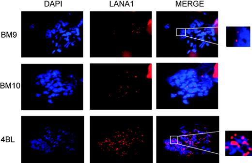 Figure 5. Nuclear dispersion of LANA1 by BM9 and BM10 expression. Quantitation of LANA1 speckles in metaphase spreads demonstrates diminished chromatin-associated LANA1 in cells expressing BM9 or BM10 compared with 4BL. Magnification × 1000.