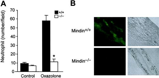 Figure 2. Impaired neutrophil response in oxazolone-induced acute dermatitis in mindin-deficient mice. (A) Neutrophil responses in the ear dermis of oxazolone-treated mice. Oxazolone was applied to the ears of wild-type and mindin-/- mice (n = 3). Six hours later, neutrophil migration to the affected area was examined in tissue sections. Shown are mean ± SD of neutrophils. Data are representative of 2 independent experiments. *P < .001. (B) Immunofluorescence staining of ear dermis of wild-type and mindin-/- mice. Tissue sections were stained with polyclonal antimindin antibody followed by FITC-anti–rabbit immunoglobulin G (IgG). Tissue structure under light microscopy with a 10 ×/0.30 objective lens is also shown (original magnification, × 100).