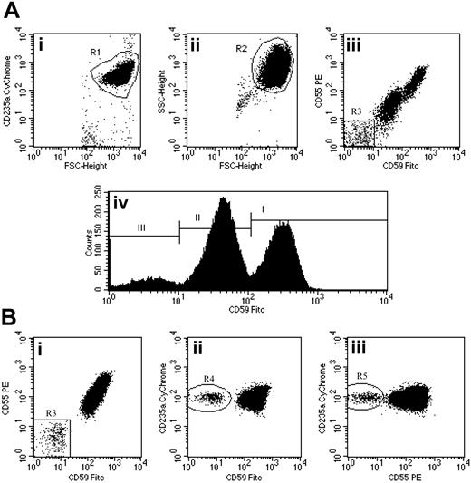 Figure 1. Flow cytometric analysis of red cells in PNH using a combination of anti-CD59 FITC, anti-CD55 PE, and anti-CD235a CyChrome. (Ai-ii) Flow cytometry plots show the gating strategy for identifying a pure population of red cells. An initial region (R1) is set on CD235a+FSCHigh events. A second region (R2) is then drawn around the logFSC/SSC characteristics of these cells. Only events that meet both these criteria are analyzed. (Aiii) CD59 and CD55 bivariate expression on these erythroid events. A small population of complete deficiency cells (type III) are detected (region R3 = 8.0%). (Aiv) Histogram analysis of CD59 expression also shows a major population of partially deficient cells (type II) comprising 53.9% of the total. Type I (normal expression) cells comprise 38.1% of the total. (Bi-iii) Detection of a very small red cell clone in a patient with PNH-sc/aplastic anemia. The red cell PNH clone comprises 0.4% of the total red cells (Bi). Confidence that this population is not an artifact is shown by simultaneous CD59 (Bii) and CD55 (Biii) deficiency and strong expression of CD235a. Illustration enhanced by A. Y. Chen.