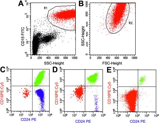 Figure 2. Flow cytometric analysis of granulocytes in PNH using a combination of anti-CD15 FITC, anti-CD24 PE, and anti-CD16 PE:Cy5. Flow cytometry plots (A-B) show the gating strategy for identifying a pure population of granulocytes based on light scatter characteristics and a transmembrane lineage marker (CD15). An initial region (R1) is set on CD15a+SSCHigh events (A). A second region (R2) is then drawn around the FSC/SSC characteristics of these cells to further refine the gating procedure (B). Only events that meet both these criteria are analyzed. (C-E) Using this combination, normal eosinophils (blue) can be clearly separated from PNH cells (red) and normal granulocytes (green). Plots are from 3 representative patients with PNH. (C) A small PNH granulocyte clone of 0.18% of total granulocytes in a patient with aplastic anemia (PNH-sc/aplastic anemia). (D) A larger PNH granulocyte clone of 8.7% in a patient with aplastic anemia (PNH/aplastic anemia). (E) Plot is from a patient with classic PNH and shows a large PNH granulocyte pool (98.8%). In this instance, the majority of hematopoiesis is derived from PNH stem cells. There is some residual normal granulocyte production (the 1% of cells that are CD16+CD24+) and this population serves as an internal positive control for antibody staining. Illustration enhanced by A. Y. Chen.