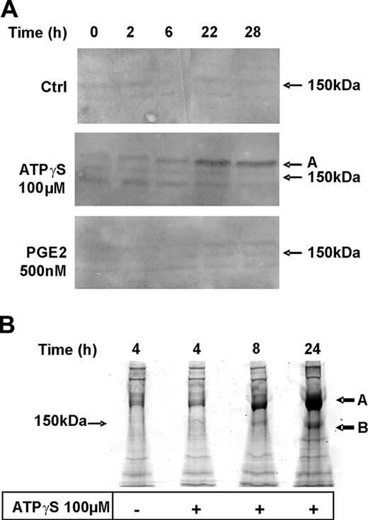 Figure 2. Proteomics analysis of TSP-1 production by DCs in response to ATPγS. (A) DCs were either untreated (Ctrl) or treated with ATPγS (100 μM) or PGE2 (500 nM) for different periods of time in complete medium. Supernatants were collected at the end of incubation to perform Western blotting using an anti–TSP-1 rabbit polyclonal antibody (1:200). (B) DCs were treated with ATPγS (100 μM) for 4, 8, or 24 hours in serum-free medium. At the end of incubation, supernatants were collected and proteins were extracted and loaded on an 8% SDS–polyacrylamide gel. After colloidal Coomassie blue staining, proteins of interest (black arrows A and B) were excised and in-gel digested by trypsin.