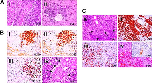 Figure 3. Development of multiorgan lymphoid infiltrates in Il12rb2 KO mice. (A) Liver from a 15-month-old Il12rb2 KO mouse shows periarteriolar lymphoid cuff (Ai). At the age of 18 months, the ectopic lymphoid infiltrate appears arranged in follicle-like structures (Aii). Magnification, × 400; H&E staining. (B) Ectopic lymphoid infiltrates in the kidney from a 18-month-old mouse (Bi-iv). These infiltrates are mostly composed of B220+ (Bi), CD43+ (Bii), and PCNA+ (Biii) cells and compress the glomeruli and tubules. Lymphoid aggregates can invade epithelial structures (lymphoepithelial lesions indicated by arrows in Biv). Magnification, × 400. (C) Lymphocytic infiltration develops in the submandibular gland of a 15-month-old mouse (Ci). The centroblastic-centrocytic follicular infiltrate (Ci, arrows) is predominantly composed of B220+ B cells (Cii), bordered by small mature lymphoid cells (Ci, arrowheads) displaying a CD3+ T-cell phenotype (Ciii), with intermingled FDC-M2+ cells (Civ). This ectopic lymphoid infiltrate organizes close to PNAd+ vessels (inset in Civ). Magnification, × 400.