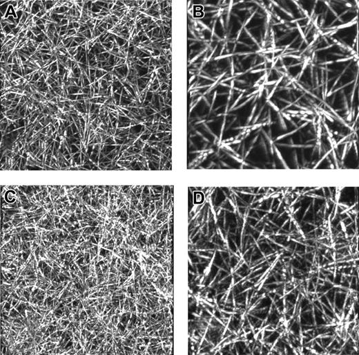 Figure 2. Images of α251 and control fibrin clots from laser scanning confocal microscopy. Thrombin at a final concentration of 0.9 IU/mL was added to recombinant control or Aα251 fibrinogen at a 4.4-μM final concentration in 20 mM HEPES, pH 7.4, 0.15 M NaCl, 5 mM CaCl2. Images of 3-dimensional reconstructions of optical sections of control (A, B) and α251 (C, D) fibrin networks obtained by laser scanning confocal microscopy. Original magnifications are as follows: panels A and C: 48 × 48 × 48 μm3; panels B and D: 4 × 24 × 24 μm3.
