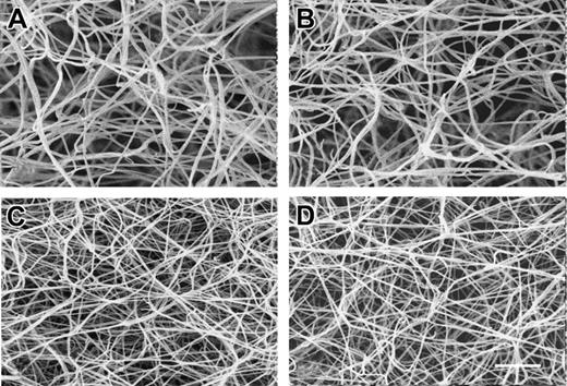Figure 3. Scanning electron microscopy of α251 and control fibrin. Thrombin at a final concentration of 0.9 IU/mL was added to recombinant control or Aα251 fibrinogen at a 4.4-μM final concentration in 20 mM HEPES, pH 7.4, 0.15 M NaCl, 5 mM CaCl2. (A) Fibrin made from control fibrinogen. (B) Fibrin made from control fibrinogen in the presence of 1 IU/mL factor XIIIa. (C) Fibrin clot made from Aα251 fibrinogen. (D) Fibrin clot made from Aα251 fibrinogen in the presence of 1 IU/mL factor XIIIa. Magnification bar equals 1000 nm.