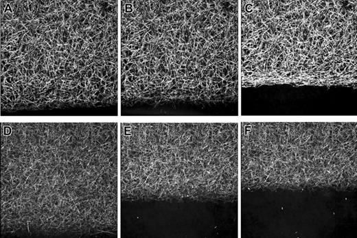 Figure 4. Fibrinolysis of α251 and control fibrin clots as visualized by laser scanning confocal microscopy. Series of micrographs showing the dynamic lysis of control (top panels) and α251 (bottom panels) fibrin clots by rtPA (6 nM) and Glu-plasminogen (2.5 μg/mL); clots were prepared as described in Figure 2. Lysis-front motion was visualized by scanning this region of the clot every 2 minutes. The lysis front progressed as a straight and sharp line in both clots with a higher velocity in α251 fibrin as compared with control fibrin. Each micrograph is a reconstruction from optical sections representing a volume of 146 × 146 × 20 μm3. A,D: 2 minutes; B,E: 4 minutes; C,F: 6 minutes.