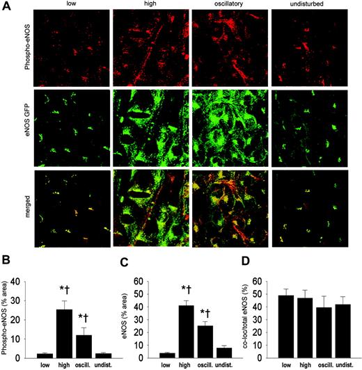 Figure 6. Intracellular localization of eNOS-GFP and phospho-eNOS in areas of the carotid artery experiencing different shear stress patterns after 2 days of cast placement. (A) In the top panel, phospho-eNOS in corresponding vascular regions visualized by en face immunofluorescence staining. Indicated are the low shear stress region (low), the high shear stress region (high), the oscillatory shear stress region (oscillatory), and the control region (undisturbed). Fluorescence was monitored by en face confocal microscopy in stacks of 500 × 500 μm each. In the middle panel, fluorescence of eNOS-GFP in endothelial cells located in the 3 different shear stress regions and in the contralateral carotid artery. In the bottom panel the top and middle panels are merged, showing the colocalization signal in yellow. (B-D) Quantification of the localization of (B) the phospho-eNOS, (C) the eNOS-GFP, and (D) the colocalization signals in response to the different shear stress fields in percentages of the total area (B-C) or of the total eNOS-GFP signal (D); n = 5, *P < .05 versus low shear stress. †P < .05 versus undisturbed shear stress. All data are means ± SEM.