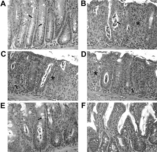 Figure 2. Histopathologic changes in the colon and small intestine of lethally irradiated host 7 days after the injection of donor cells. All hosts received 0.125 × 106 CD4 + T cells and/or 2 × 106 TCD bone marrow cells. (A) Colon of a control host given only TCD bone marrow cells. Arrows show mucin-containing goblet cells. (B) Colon of a host given WT CD4+ T cells and 2 × 106 TCD bone marrow cells. An asterisk indicates infiltrate in area of crypt drop-out; and arrow, crypt abscess. (C) Colon of a host given CD62L-/- CD4+ T cells and TCD bone marrow. An asterisk indicates inflammatory infiltrate and crypt drop-out. (D) Colon of a host given β7-/- CD4+ T cells. Inflammatory infiltrate and crypt drop-out are present. (E) Colon of a host given CD62L-/-/β7-/- CD4+ T cells. Goblet cells are retained in crypt walls (arrow), and crypt drop-outs with infiltrate are minimal. (F) Small intestine of a host given WT CD4+ T cells. Villi are intact and infiltrate is minimal. Tissue sections were stained with hematoxylin and eosin; original magnification × 300. Each panel is representative of each of 3 hosts examined.