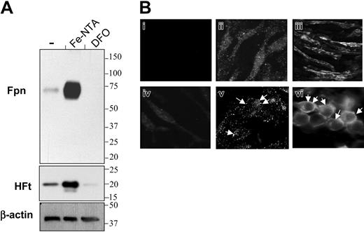 Figure 1. Effects of iron treatments on expression and subcellular localization of ferroportin in BMDMs. Cells were cultured with or without Fe-NTA or DFO for 16 hours and then processed for protein expression and localization. (A) Postnuclear extracts (10 μg/lane) were analyzed by Western blot using antiferroportin (Fpn), anti–H ferritin (HFt), or anti–β-actin (loading control) antibodies, respectively. The position and size in kilodaltons of molecular mass markers are indicated on the right. (B) Immunofluorescence staining of endogenous ferroportin in control (ii,v), Fe-NTA-(iii,vi), and DFO-treated (iv) BMDMs analyzed by fluorescence microscopy. Panels Bi-iv and Bv-vi correspond to 2 independent experiments, respectively. Panel Bi corresponds to negative control staining when omitting the primary antiferroportin antibody during immunofluorescence procedure. (Bv-vi) Arrows indicate vesicular staining in untreated cells and cell surface staining of ferroportin after cellular iron loading, respectively. Original magnification, (Bi-iv) × 40, (Bv-vi) × 100.