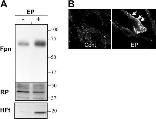 Figure 2. Expression and subcellular localization of ferroportin after erythrophagocytosis. (A) BMDMs were treated with artificially aged red blood cells as described in “Materials and methods.” After 8 hours, membrane preparations and cytosolic extracts were isolated and processed for Western blot analysis using antiferroportin (top, membrane fraction) or anti–H ferritin (bottom, cytosolic fraction). Middle panel shows Red Ponceau (RP) staining of PVDF membrane after transfer used as a control of loading for the ferroportin detection. The position and size in kilodaltons of molecular mass markers are indicated on the right. (B) Immunofluorescence staining of endogenous ferroportin in control cells or in cells 8 hours after erythrophagocytosis. After EP, ferroportin presents both strong vesicular and cell-surface staining (arrows).