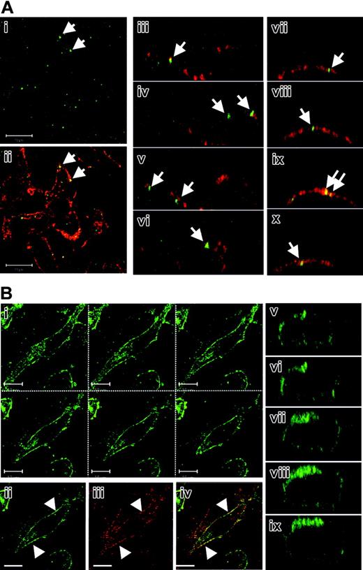 Figure 3. Cell surface expression of ferroportin in BMDMs. (A) In untreated BMDMs, endogenous ferroportin (green) and CD11b/Mac1 (red) fluorescence labeling were analyzed using confocal microscopy. Arrows in panel Ai show the vesicular staining of ferroportin alone, whereas arrows in panels Aii-x illustrate the cell surface staining of ferroportin and its partial colocalization with the cell surface marker CD11b. (Ai-ii) XY sections; (Aiii-x) XZ sections. (B) In iron-treated BMDMs, endogenous ferroportin (green, Bi-ii,v-ix) and CD11b/Mac1 (red, Biii) fluorescence labeling were analyzed using confocal microscopy. Serial XY (Bi) and XZ (Bv-ix) sections clearly show the strong plasma membrane localization of ferroportin in iron-overloaded cells. Panel Biv corresponds to the merge of panels Bii and Biii and shows colocalization of ferroportin with CD11b/Mac1.