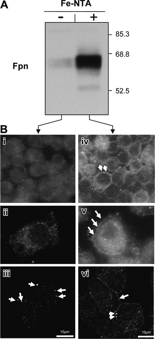 Figure 4. Effects of iron treatment on expression and subcellular localization of ferroportin in J774 macrophages. Expression and subcellular localization of ferroportin were studied in macrophage cell line J774 untreated (-; Bi-iii) or treated (+; Bii-vi) with Fe-NTA for 16 hours. (A) Western blotting. Membrane proteins (15 μg/lane) were separated on SDS-PAGE, electrotransferred on PVDF membrane, and analyzed with our antiferroportin antibody (Fpn). (B) Ferroportin immunofluorescence staining was analyzed with classic (Bi-ii, Biv-v) or confocal (Biii, Bvi) microscopy. In untreated cells (Bi-iii), ferroportin staining was mainly vesicular (arrows) with some accumulation at the periphery of the cells. After iron treatment (Biv-vi), ferroportin protein was clearly shown at the cell surface of these cells (arrows).
