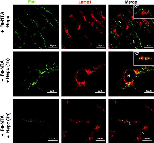 Figure 6. Effect of hepcidin on ferroportin and Lamp1 subcellular localization in BMDMs. Presence of ferroportin at the cell surface of macrophages was increased by Fe-NTA (16 hours, 100 μM). In iron-overloaded cells, human hepcidin was added to cell culture media 1 or 3 hours before fixation of the cells for immunofluorescence procedure. Cells were stained with both rabbit antiferroportin (Fpn) and a rat anti-Lamp1 antibody followed by an Alexa 488–conjugated goat antirabbit (green) and an Alexa 588–conjugated goat antirat (red). The merge between the green and the red fluorescence reveals some yellow color corresponding to partial colocalization of ferroportin with Lamp1 protein in hepcidin-treated samples. N indicates the position of the nucleus.
