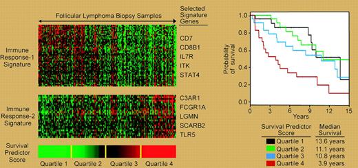 Molecular prognostic model of follicular lymphoma based on signatures of infiltrating “immune” cells.