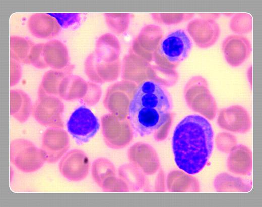 Jiri Pavlu and Nicki Panoskaltsis, Imperial College London