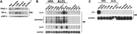 Figure 3. Expression of NF-κB–or Bcl-3–dependent target genes and IL9 in lymphoma cell lines. (A) Expression analysis of classic NF-κB target genes. Whole-cell extracts of various lymphoma cell lines were analyzed for expression of TRAF-1, Bcl-xL, and cIAP-2 by Western blot. (B) Expression of Bcl-3–dependent genes. mRNA analysis of IL10, SERPINB1, SLPI, and, as control, GAPDH of various lymphoma cell lines by Northern blot. (C) IL9 mRNA expression analysis of various lymphoma cell lines by Northern blot. GAPDH expression is shown as control.