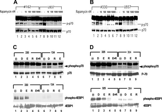 Figure 4. Rapamycin inhibits mTOR in primary AML samples. (A-B) Patient samples were thawed and incubated for 16 hours in different concentrations of rapamycin as shown. As controls, U937 cells were similarly incubated. After incubation, cells were harvested, lysed, and analyzed for expression and phosphorylation of p70S6 kinase by Western blotting. (C-D) Patient samples were thawed and incubated for 16 hours in nothing (-), 0.1% DMSO (D), 10 μM etoposide (E), 10 μM rapamycin (R), or a combination of etoposide and rapamycin at the same concentrations (E + R). Cells were harvested, lysed, and analyzed by Western blotting.