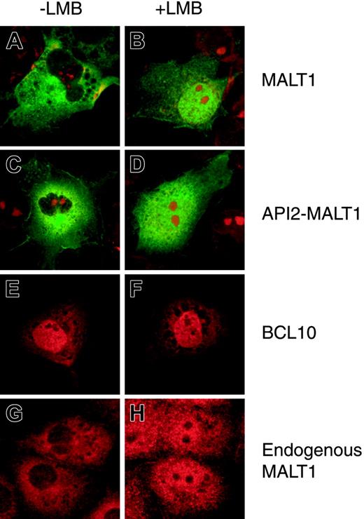 Figure 1. Subcellular localization of MALT1, API2-MALT1, and BCL10 with or without LMB treatment. Subcellular localization of MALT1-flag, flag-API2-MALT1, and myc-BCL10 transiently expressed in COS7 cells (A-F): 2 × 104 COS7 cells were transfected with the following expression vectors: MALT1-flag, 0.2 μg pcDNA3-MALT1-flag without (A) or with 4 ng/mL LMB (B); flag-API2-MALT1, 0.2 μg pcDNA3-flag-API2-MALT1 without (C) or with 4 ng/mL LMB (D); myc-BCL10, a mixture of 0.02 μg pcDNA3-myc-BCL10 and 0.18 μg pcDNA3 without (E) or with 4 ng/mL LMB (F). The LMB treatment was conducted at 18 hours after transfection. At 21.5 hours after transfection, 25 μM MG132 was added only to the wells for MALT1-flag (A-B), and 24 hours after transfection, the cells were examined with an immunofluorescence microscope. Mouse anti-flag antibody was used for flag-tagged constructs; fluorescein goat anti-mouse IgG, as the second antibody for the mouse anti-flag antibody; rabbit anti-human BCL10 antibody, for myc-BCL10; and Alexa Fluor 546 goat anti-rabbit IgG, as the second antibody for the rabbit anti-BCL10 antibody. Nuclei were stained with propidium iodide except for the cells expressing myc-BCL10. Subcellular localization of endogenous MALT1 in COS7 cells (G-H): COS7 cells treated without (G) or with 4 ng/mL LMB (H) for 6 hours were examined. Rabbit anti-MALT1 polyclonal antibody was used as the first antibody and Alexa Fluor 546 goat anti-rabbit IgG as the second antibody for the rabbit anti-MALT1 polyclonal antibody.