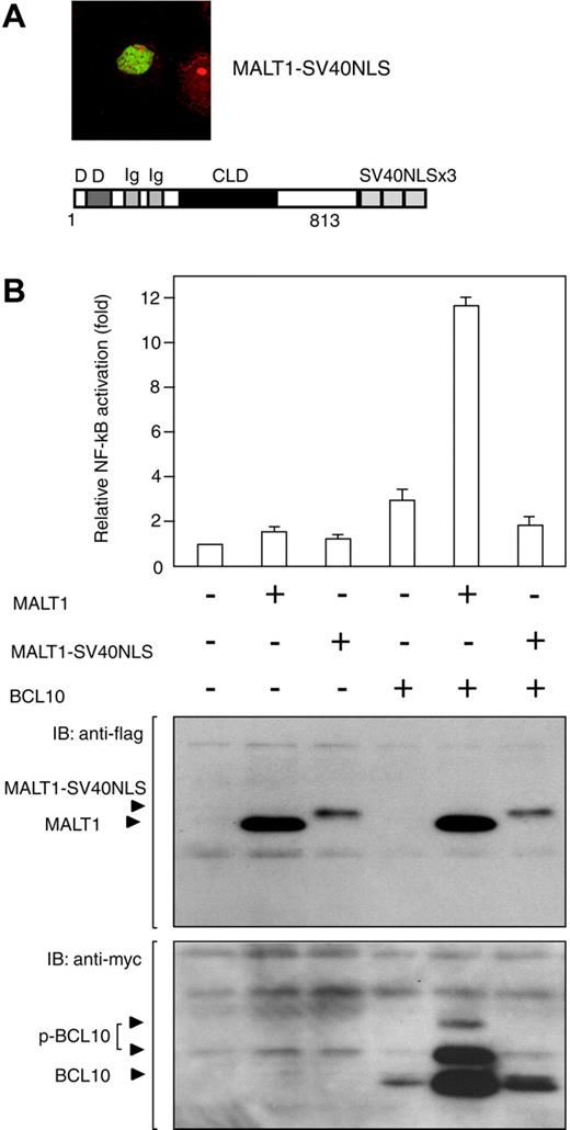 Figure 6. Cancellation of NF-κB activity by nuclear localization of MALT1 in the presence of BCL10. (A) The cells transfected with MALT1-SV40NLS expression vectors were examined by means of immunofluorescence analysis. The protein structure of the MALT1-SV40NLS expression vector is shown below the immunofluorescence image. Numbers below the structures represent the amino acid number of MALT1. (B) COS7 cells (1 × 105) were transfected with NF-κB-dependent luciferase reporter vectors, an internal control vector (phRL SV40), and the following expression vectors: for control, pcDNA3-myc; for MALT1, pcDNA3-MALT1-flag; for MALT1-SV40NLS, pMALT1-flag-SV40NLS; for BCL10, pcDNA3-myc-BCL10; for MALT1 + BCL10, pcDNA3-MALT1-flag and pcDNA3-myc-BCL10; for MALT1-SV40NLS + BCL10, pMALT1-flag-SV40NLS and pcDNA3-myc-BCL10. At 24 hours after transfection, total extracts were used to measure luciferase activity, using the method of the Dual-Luciferase Reporter Assay System (Promega) (top panel) and to detect each of the proteins by means of Western blotting (bottompanel). NF-κB activity was examined 3 times, and one set of representative data is shown. IB indicates immunoblot. Error bars indicate standard deviation.