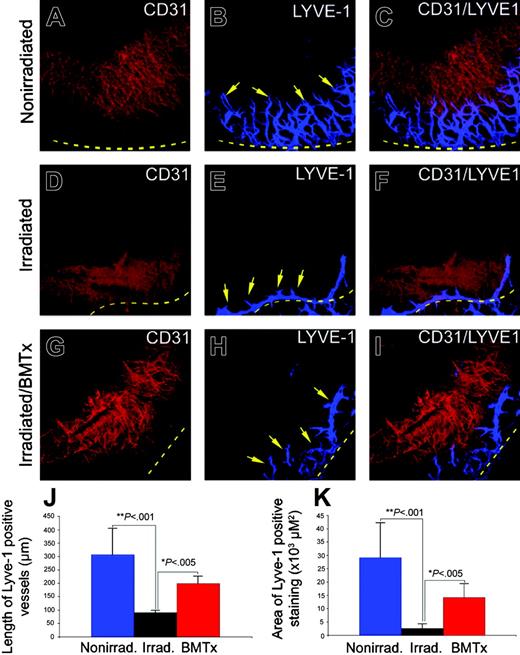 Figure 1. Bone marrow cells contribute to lymphangiogenesis. A pellet containing 80 ng FGF-2 was implanted into each cornea micropocket of nonirradiated (A-C), irradiated (D-F), and irradiated with EGFP+-transplanted BM (G-I) C57BL/6 mice. At day 7 of implantation, corneal tissues were stained with a combination of anti-CD31 antibodies (A,D,G) and anti-LYVE-1 antibodies (B,E,H). CD31 and LYVE-1+ signals of the same sections were further analyzed for overlapping signals by CLSM analysis (C,F,I). Images were captured using a Plan Neofluar 10 ×/0.3 NA objective lens. Quantification of length (J) and area (K) of LYVE-1+ vessels from 5 to 7 sections.