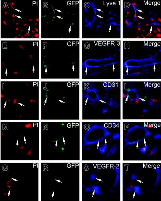 Figure 3. High-power microscopic analysis of the presence of EGFP+ cells in corneal vessels. Immunohistologically stained cryosections of FGF-2-implanted corneal tissues were analyzed by CLSM. EGFP+ signals were overlapped with LYVE-1 (B-D), VEGFR-3 (F-H), CD31 (J-L), CD34 (N-P), or VEGFR-2 (R-T). Tissue cell nuclei were counterstained with PI (red in panels A,E,I,M,Q). Arrows point to overlapping positive signals of EGFP and vessels. Images were captured with a 40 ×/1.30 NA Plan Neofluar objective lens.