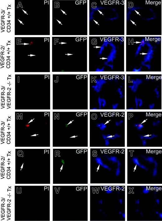Figure 5. Incorporated EGFP+ BM cells express VEGFR-2 or VEGFR-3. Infusion of FACS-sorted VEGFR-3/CD34+/+ (A-D,M-P), VEGFR-2/CD34+/+ (E-H,Q-T), or VEGFR-3/VEGFR-2-/- (I-L,U-X) cells into irradiated mice. The FGF-2-induced vascular structures were immunohistologically analyzed for colocalization of double-positive signals of EGFP/VEGFR-3+/+ (A-L) and EGFP/VEGFR-2+/+ (M-X) cells. Arrows in panels D, H, L, P, T, and X point to overlapping signals. Images were captured with a 40 ×/1.30 NA Plan Neofluar objective lens.
