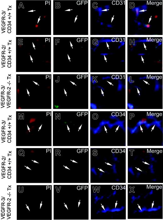 Figure 6. Incorporated EGFP+ BM cells express CD31 or CD34. Infusion of FACS-sorted VEGFR-3/CD34+/+ (A-D,M-P), VEGFR-2/CD34+/+ (E-H,Q-T), or VEGFR-3/VEGFR-2-/- (I-L,U-X) cells into irradiated mice. The FGF-2-induced vascular structures were immunohistologically analyzed for colocalization of double-positive signals of EGFP/CD31 (A-L) and EGFP/CD34 (M-X). Arrows in panels D, H, L, P, T, and X point to overlapping signals. Images were captured with a 40 ×/1.30 NA Plan Neofluar objective lens.