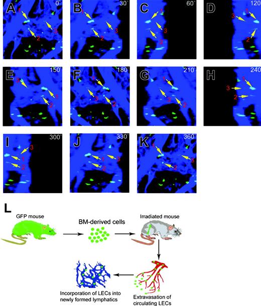 Figure 7. Incorporation of bone marrow-derived cells in tumor lymphatic vessels. High-resolution confocal microscopic analysis was used to show colocalization of EGFP (green) and LYVE-1 (blue) overlapping signals of lymphatic vessels at the surface of tumor tissues. EGFP+ cells overlapping with LYVE-1 signals were marked with numbers (1 to 3) and arrows (A-K). Schematic diagram demonstrating possible mechanisms of bone marrow-differentiated CEPCs in the participation of lymphangiogenesis. The bone marrow cells have to be extravagated from the blood vessels and incorporated into the newly formed lymphatics (L). Images in panels A-K were captured with a 10 ×/0.3 NA Plan Neofluar objective lens.