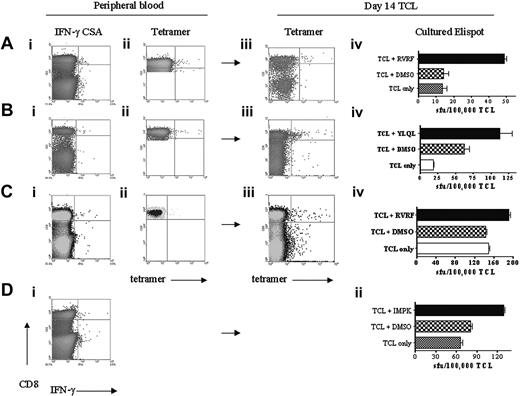 Figure 3. Functional analysis of short-term T-cell cultures. PBMCs were isolated and subjected to CSA and staining with HLA-peptide tetramer. ELISPOT analysis on freshly isolated PBMCs was unreliable due to the low frequency of responding cells (data not shown) and so T cells were cultured with peptide for 14 days prior to an ELISPOT assay. Staining with HLA-peptide tetramer was performed at the same time. (A) Patient 21. (Ai) CSA of PBMCs illustrating 0.03% CD8 specific to CGAg peptide MAGE-A1289-298. (Aii) MAGE-A1-289-298 tetramer stain of PBMCs also stained 0.03% of the CD8 T-cell pool. (Aiii) MAGE-A1-289-298 tetramer stain of T-cell line after 14 days of culture showed 0.09% of CD8 T cell-binding tetramer. (Aiv) IFN-γ ELISPOT analysis at day 14 T-cell line (TCL) revealed that 0.04% of T cells responded to MAGE-A1-289-298 peptide. Similar analysis for peripheral blood in patient 22 revealed 0.04% of CD8+ T cells specific to MAGE-A2-157-166 peptide(Bi) and 0.04% of CD8 staining with MAGE-A2-157-166 tetramer (Bii). At day 14, 0.26% of CD8 stained with tetramer (Biii) and 0.05% of T cells responded to MAGE-A2-157-166 peptide in ELISPOT assay (Biv). (C) Similar analysis for peripheral blood in patient 7 illustrated 0.02% of CD8+ T cells specific to MAGE-A1-289-298 (Ci) and 0.03% of CD8 staining with MAGE-A1-289-298 tetramer (Cii). At day 14, 0.05% of CD8 stained with tetramer (Ciii) and 0.04% of T cells responded to MAGE-A1-289-298 peptide in ELISPOT assay (Civ). (D) A tetramer for the peptide MAGE-A3-195-203 restricted to HLA-A*2401 was not available; however, analysis of peripheral blood from patient 23 revealed 0.05% of CD8+ T cells specific to MAGE-A3-195-203 peptide by IFN-γ CSA. At day 14, 0.05% of T cells responded to the peptide in ELISPOT assay (Dii). (Note: To maximize the number of events analyzed by FACS, PBMCs were gated on CD8 only when tetramer staining was performed on peripheral blood.)