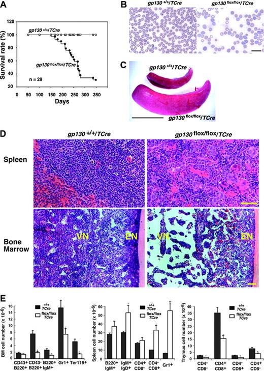 Figure 3. Shortened survival and defective hematopoiesis in gp130flox/flox/TCre mice. (A) Shortened survival of gp130flox/flox/TCre mice. (B) Peripheral-blood smear of a 16-week-old gp130flox/flox/TCre mouse exhibits polychromasia and anisopoikilocytosis of erythrocytes. Scale bar represents 20 μm. Objective, × 63/1.4 NA. (C) Splenomegaly in a 12-week-old gp130flox/flox/TCre mouse. Scale bar represents 1 cm. (D) Spleen of a 12-week-old gp130flox/flox/TCre mouse exhibits extramedullary hematopoiesis with abundant megakaryocytes. Bone marrow of a 16-week-old gp130flox/flox/TCre mouse exhibits normal cellularity in the endosteal niche (EN) adjacent to bone. In contrast, the vascular niche (VN) is markedly hypocellular, except for retention of normal numbers of megakaryocytes. Scale bar represents 50 μm. Objective, × 20/0.5 NA. (E) Quantification of blood cells of B-cell, T-cell, myeloid, and erythroid lineage expressing the indicated markers in bone marrow (BM), spleen, and thymus of gp130+/+/TCre and gp130flox/flox/TCre mice. Data represent the mean ± SD of 5 mice (age 12 weeks) in each genotype. *P < .05 and **P < .01 compared with gp130+/ +/TCre.
