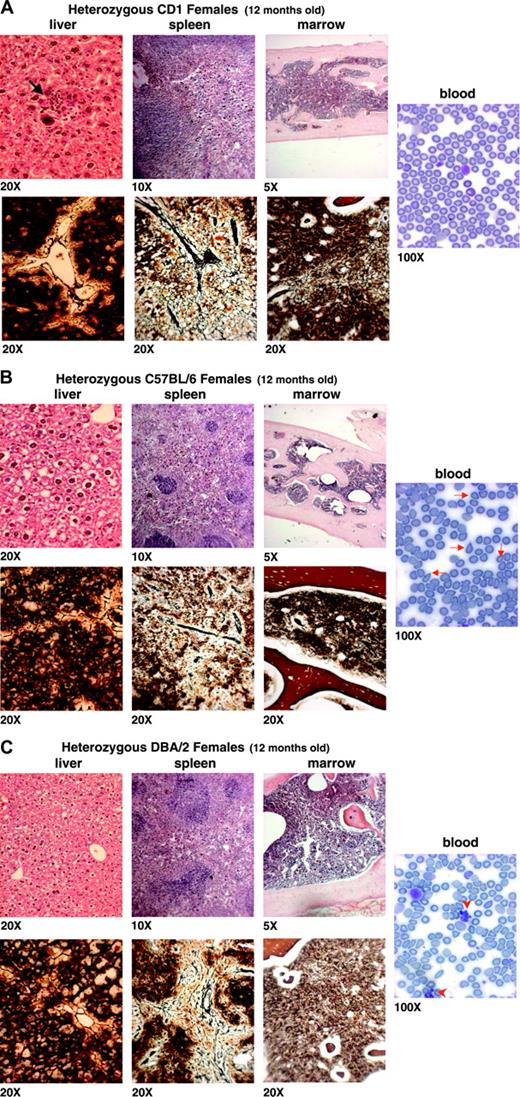 Figure 2. Histologic analysis of the myelofibrotic trait in 12-month-old heterozygous F1 Gata1low females carrying the mutation in a predominantly CD1, C57BL/6, or DBA/2 background. Blood smears are shown on the right panels, while hematoxilin-eosin and Gomori staining of liver, spleen, and marrow are shown on the top and bottom panels, as indicated. The genetic background of the mice analyzed is specified in Figure 1, while the quantification of Mk frequency and of the fibrosis in each animal group is presented in Table 2. The arrow in the liver section in panel A indicates an erythroid nest within the parenchyma, already detectable at 12 months in CD1 mutants, while the arrowheads on the blood smears in panel C indicate clusters of normal platelets, that is, deriving from the stem cell population that had inactivated the X chromosome carrying the Gata1low allele. These clusters were detected at high frequency, mainly on blood smears of heterozygous DBA/2 mutants. Similar results were obtained in at least 3 to 6 animals for experimental points. Original magnifications are indicated at the bottom of each panel.
