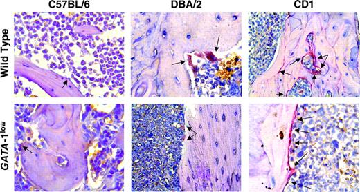 Figure 4. Tartrate-resistant acid phosphatase staining of representative bone marrow sections from 12-month-old heterozygous F1 Gata1low females carrying the mutation in a predominantly C57BL/6 and in hemizygous F2 males of CD1 and DBA/2 backgrounds, as indicated. Staining of the corresponding sections from wild-type littermates also are indicated. Results are representative of those obtained in 3 animals per experimental group. The presence of osteoblasts is indicated by arrows. Original magnification, × 20.