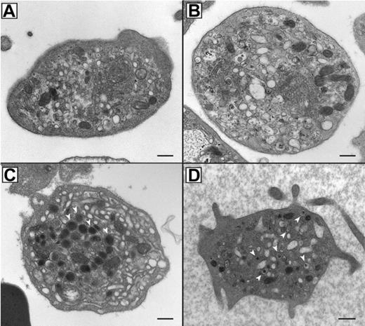 Figure 2. Absent α-granules and increased δ-granules in platelets from patients containing mutations in VPS33B. Thin-section transmission electron micrographs of representative platelets from related ARC fetal (A) and neonatal (B) blood, control fetal (C), and unrelated ARC neonatal (D) blood. Magnifications are ×30 000 (A-C) and ×25 000 (D). The black bar represents 500 nm. Multiple α-granules (white arrows) are seen in the control platelet (C), and are absent in ARC platelets (A, B, D). The dark-staining structures seen in ARC platelets (A, B, D) contain distinct internal membranes and may represent mitochondria. Prominent Golgi structures are also visible in ARC platelets (eg, near the center of the platelet in panel B). Multiple dark densities encircled by a lighter halo representing δ-granules (arrows) are visualized in a single thin-section EM image of a neonatal ARC platelet (D), where one would expect to see less than the average of 0.4 δ-granules per platelet thin section observed in adults.34