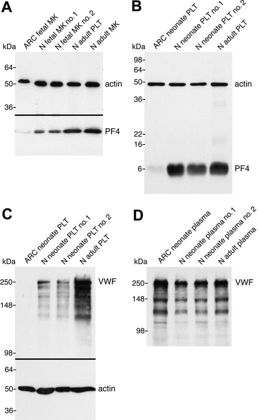 Figure 3. α-granule protein deficiencies in ARC megakaryocytes and platelets. Immunoblots comparing megakaryocyte (MK) and platelet (PLT) whole-cell lysates or plasma from ARC and normal (N) fetal, neonatal, and adult sources as indicated for each lane. (A) Markedly reduced PF4 content in ARC fetal megakaryocytes (lane 1) compared with control fetal megakaryocytes (lanes 2, 3), control adult platelets (lane 4), and megakaryocytes (lane 5) were observed (reduced 10% SDS-PAGE). Lysate from equivalent numbers of megakaryocytes (CD41+-labeled cells) was loaded for lanes 1 to 3. Equivalent protein loading is indicated by visualizing actin on the same blot. (B) Significantly decreased PF4 was also observed in ARC neonatal platelets (lane 1) compared with normal neonatal (lanes 2, 3) and adult (lane 4) platelets (reduced 15% SDS-PAGE; PF4 and actin were probed and developed simultaneously). (C) Platelet VWF is undetectable in ARC platelets (lane 1) compared with normal neonatal (lanes 2, 3) and adult (lane 4) platelets (reduced 8% SDS-PAGE). (D) In contrast, VWF was present at roughly equivalent quantities (0.5 μL plasma/lane) in plasma from patients with ARC syndrome (lane 1) compared with normal neonatal (lanes 2, 3) and adult (lane 4) control plasma (reduced 8% SDS-PAGE).