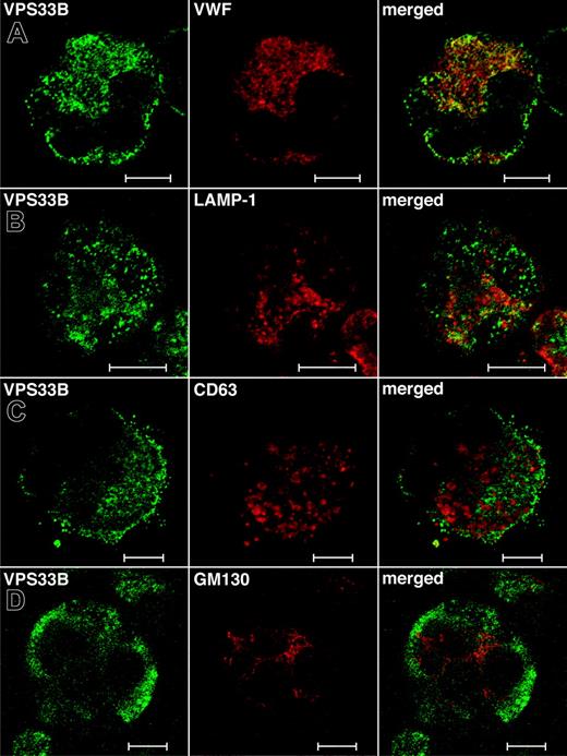 Figure 5. Immunofluorescent localization of VPS33B with α-granule, late endosome/lysosome, δ-granule/lysosome, and Golgi complex markers in normal human megakaryocytes. Human cultured megakaryocytes were cytocentrifuged onto glass slides, fixed, permeabilized, and labeled with polyclonal rabbit anti-VPS33B antibodies together with monoclonal antibodies to VWF (A), LAMP-1 (B), CD63 (C), and GM130 (D), followed by labeling with secondary Alexa Fluor 488 goat antirabbit and Cy3 donkey antimouse antibodies. Stained megakaryocytes were visualized by confocal microscopy where multilobed nuclei (unique to megakaryocytes) could be recognized readily using the differential interference contrast mode. Staining was typically granular. Representative images are shown and the white bar corresponds to 10 μm. (A) The merged images revealed significant partial colocalization (yellow) of VPS33B with VWF. (B) Although partial colocalization of VPS33B with LAMP-1 was observed (merged), it was less than with VWF. (C) VPS33B colocalized minimally with CD63 (merged). (D) No colocalization of VPS33B with GM130 was detected (merged).