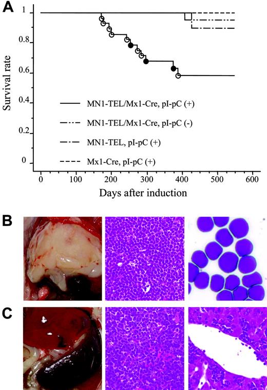 Figure 4. MN1-TEL–expressing mice develop T-lymphoid tumors de novo. (A) Survival analysis. MN1-TEL/Mx1-Cre mice (6 to 8 weeks old) were injected with pI-pC (n = 28) or PBS (n = 26). MN1-TELKI/WT (MN1-TEL) or Mx1-Cre+/WT (Mx1-Cre) mice (n = 10) were also injected with pI-pC as controls. ○ indicates T-lymphoid tumor; •, altered myelopoiesis. (B) T-lymphoid tumors in MN1-TEL–expressing mice. (Left panel) Typical thymic tumor in MN1-TEL–expressing mice. (Middle panel) H-E staining of a thymic tumor section. (Right) M-G staining of thymic tumor cells. (C) Aggressive organ infiltrations by tumor cells. (Left panel) Typical splenomegaly in mice with tumors. (Middle) H-E staining of a spleen section. (Right) H-E staining of a liver section.