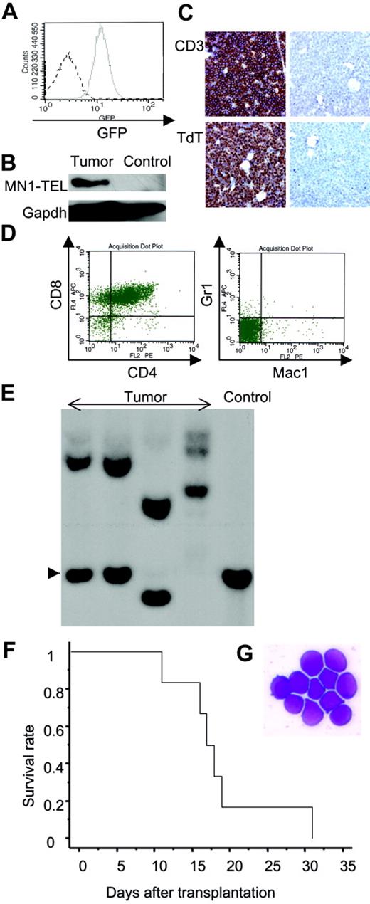 Figure 5. Phenotype of the MN1-TEL–positive T-lymphoid tumors. (A) GFP expression in MN1-TEL/Mx1-Cre tumor cells. Solid line indicates tumor cells; broken line, control MN1-TEL/Mx1-Cre thymocytes not treated with pI-pC. (B) MN1-TEL protein in tumor cells. MN1-TEL in tumor thymocytes was detected on a Western blot with a TEL C-terminal antibody. Gapdh detection was used as loading control. Control: uninduced MN1-TEL/Mx1-Cre thymocytes. (C) Immunohistochemical analysis of BM in mice with tumors. (Left column) BM stained with anti-CD3 or anti-TdT antibody. (Right column) Controls without primary antibody. Counterstaining: hematoxylin. (D) Surface marker expression in tumor cells using FCM analysis. (E) Clonality of tumor cells. Tumor DNAs digested with EcoRI were hybridized with a probe for T-cell receptor Jβ2. Control: liver DNA. Arrowhead indicates germ line band. (F) Transplantation of MN1-TEL–positive tumor cells into syngeneic recipient mice. Tumor cells (1 × 106 per recipient, n = 6) were intravenously injected into recipients that were irradiated with 7.5 Gy. A survival curve is shown. (G) M-G staining of tumor cells of the recipient BM. The same type of tumor cells as original tumors were seen in all recipients.