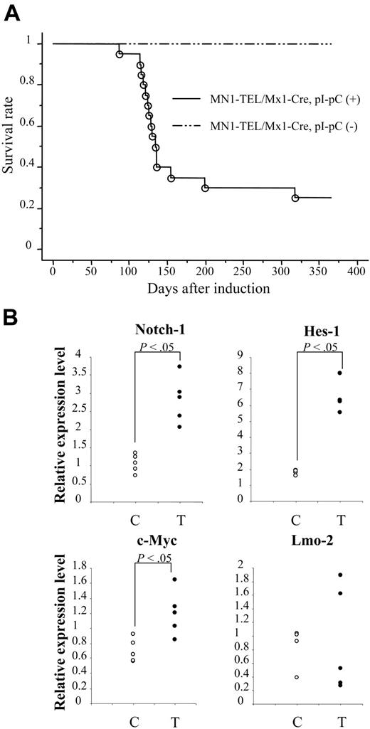 Figure 6. N-ethyl-N-nitrosourea (ENU)–induced mutagenesis accelerated tumorigenesis in MN1-TEL–expressing mice. MN1-TEL/Mx1-Cre mice (6 to 8 weeks old) were injected with ENU 10 days after treatment of the mice with pI-pC (n = 21) or PBS (n = 19). (B) Expression of T-lymphoid tumor-related genes in MN1-TEL–positive T-lymphoid tumors. Quantitative RT-PCR results are shown. The value normalized to β-actin in each sample was compared with that of a reference sample (another normal tissue, set as 1) to determine the relative expression level. C indicates control MN1-TEL/Mx1-Cre thymocytes without pI-pC (n = 5); T, tumors (n = 5).