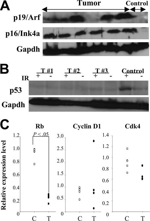 Figure 7. Altered tumor suppressor pathways in MN1-TEL–positive tumors. (A) Expression of tumor suppressors in MN1-TEL–positive tumors. Western blot of 6 tumor lysates with anti-p19Arf or -p16Ink4a antibody. Gapdh was used as loading controls. Control: normal thymocytes. (B) Lack of p53 up-regulation induced by γ-irradiation in MN1-TEL–positive tumors showing p19Arf up-regulation. Cells were harvested 3 hours after 5 Gy γ-irradiation and subjected to Western blot analysis with anti-p53 antibody. Gapdh was used as loading controls. IR indicates γ-irradiation; T, tumors. Control: normal thymocytes. Representative data are shown. (C) Down-regulation of pRb mRNA in MN1-TEL–positive tumors. Quantitative RT-PCR results are shown. C indicates control thymocytes (n = 5); T, tumors (n = 5).